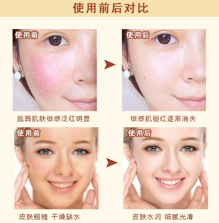 Extrahagant Philippine Chamomile Hydrating Shumin to Red Mask Powder Repair Sensitive Skin Beauty Salon Special Soft Film Powder Chính hãng mặt nạ vàng 24k