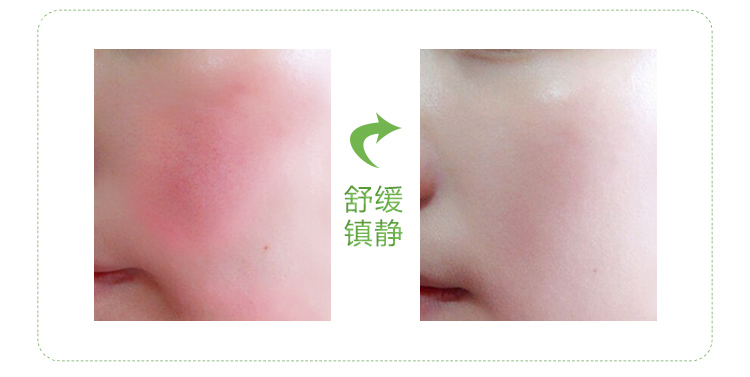 Bạc hà mặt massage mặt kem làm sạch kem trị mụn sâu làm sạch và làm sạch lỗ chân lông thẩm mỹ viện đặc biệt thương hiệu sáp tẩy trang clinique