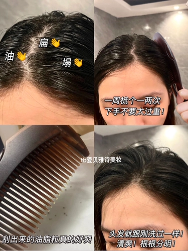 Нефтяная голова действительно любит!Энергетическое поколение третьего поколения причесывает ее волосы, чтобы избежать мытья и массажа, дамы расчесывают голову, расческу домашней подушки безопасности
