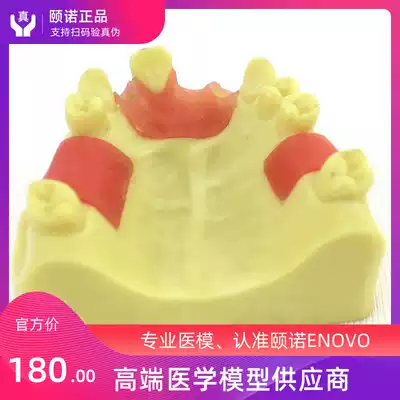 ENOVO Yinuo dentist maxillary missing implant training model oral immediate implant training maxillary bone deficiency