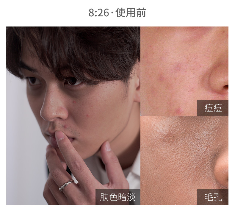 Nam lười vc Su Yan kem nam rung động cùng một đoạn kem che khuyết điểm kem trị mụn đích thực bộ trang điểm sinh viên nam - Mỹ phẩm nam giới mỹ phẩm cho nam