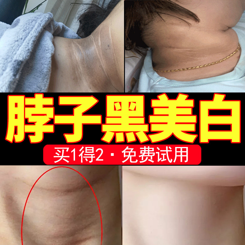 Neck cleaning is not clean how to do black thorn melanin remove the neck precipitation whitening non-artifact