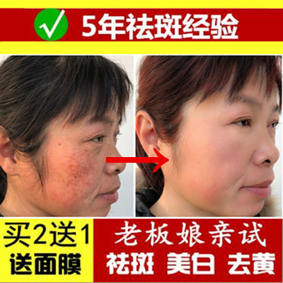 吉米cc祛斑精油茜茜焕颜精油正品去黄褐斑美白淡斑电视同款瑞士CC