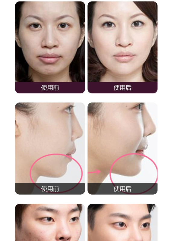 Feng chin tinh dầu cằm làm sắc nét lâu dài chỉnh sửa cằm ngắn rút lại tăng trưởng tạo tác đích thực - Tinh dầu điều trị