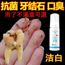 Cleaning teeth calculus dissolving tartar black smoke tooth deodorization white teeth yellowish calculus