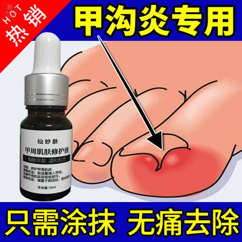 Buy 2 get 1 fairy skin nail week skin repair liquid for nail soft paronychia QIBR correction liquid granulation redness and swelling