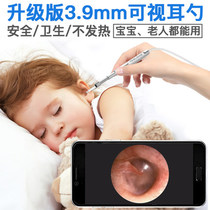 Otorhinolaryngology Endoscopy Oral Examination Instrument Body surface Detection Mobile Phone Computer Electron Microscope HD Camera