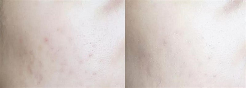 ���⣡YSL�������۵�Һ ͼ9
