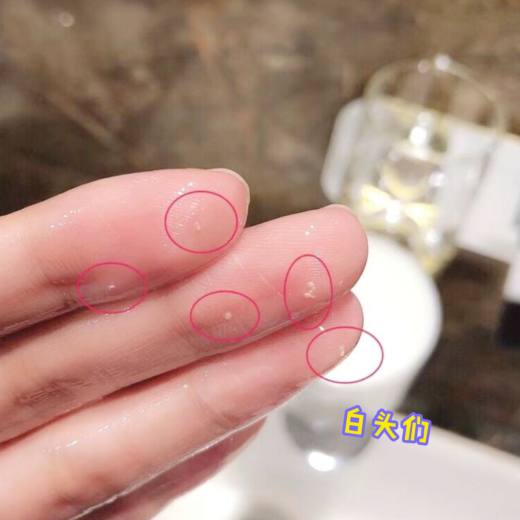 Cắt ra mụn đầu đen! Nhật suhada batake gân cơ bắp tăng làm sạch kem massage làm sạch sâu dầu tẩy trang innisfree trà xanh