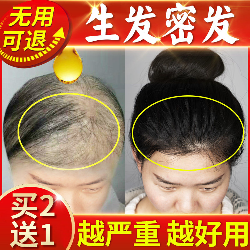 Yunnan Materia Medica hairline growth hair natural growth hair growth hair growth fast growth liquid hair growth spray