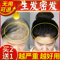 Yunnan Materia Medica hairline growth hair natural growth hair growth dense hair fast growth liquid hair growth spray