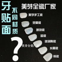 Teeth veneers whitening all-ceramic tooth veneers teeth porcelain veneers beautiful teeth ice porcelain Lingxi porcelain all-ceramic tooth veneers