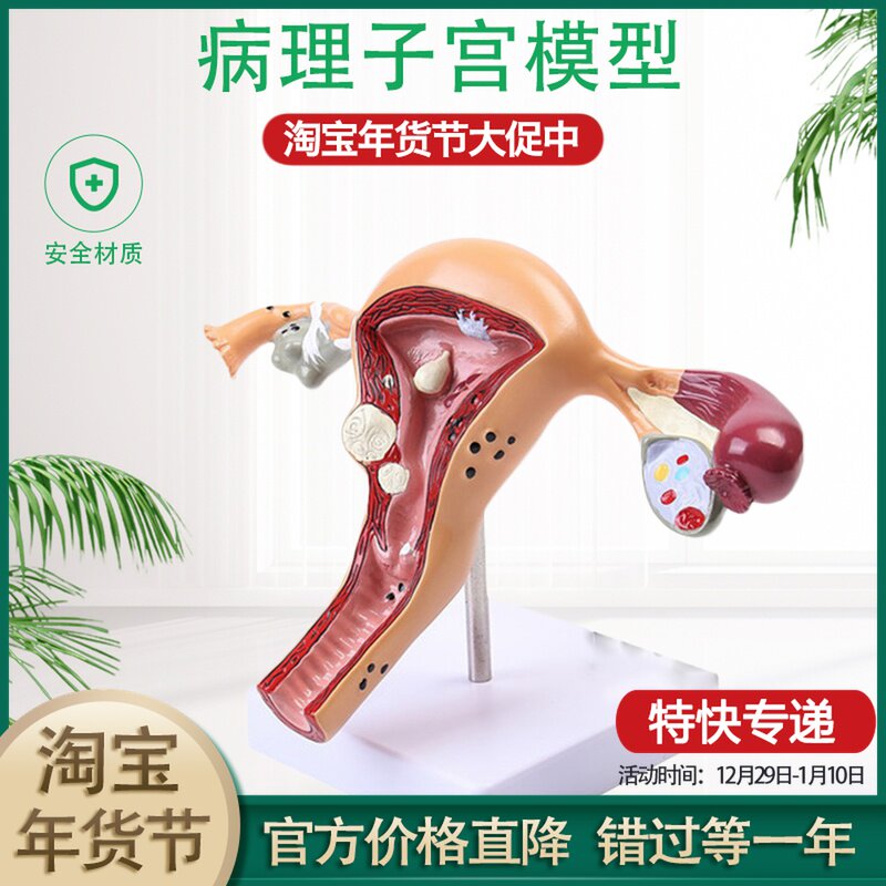 Human body model female reproductive uterus vagina ovary uterus teaching mold pathological changes popular science training teaching aids