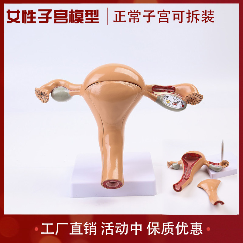 女性子宫模型 卵巢模型 女性阴道 女性内生殖器解剖模型 妇科教具