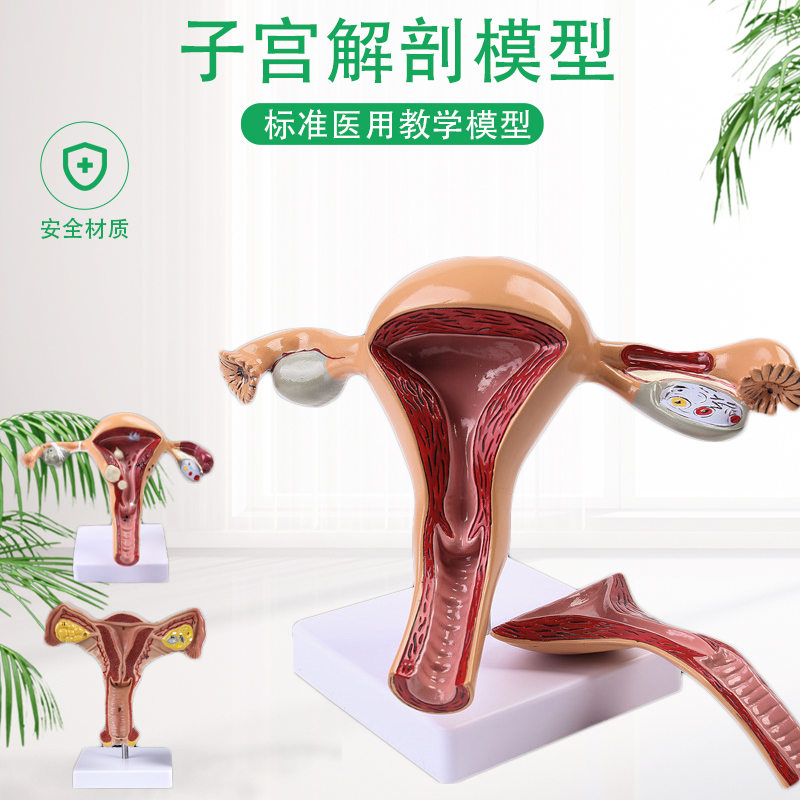 Uterus and ovary common disease model female reproductive system family planning model teaching medical model uterus model