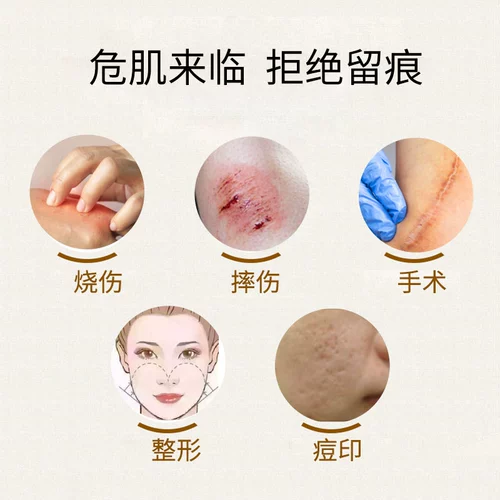 Шенгуи кремниевый гель удаление рубца