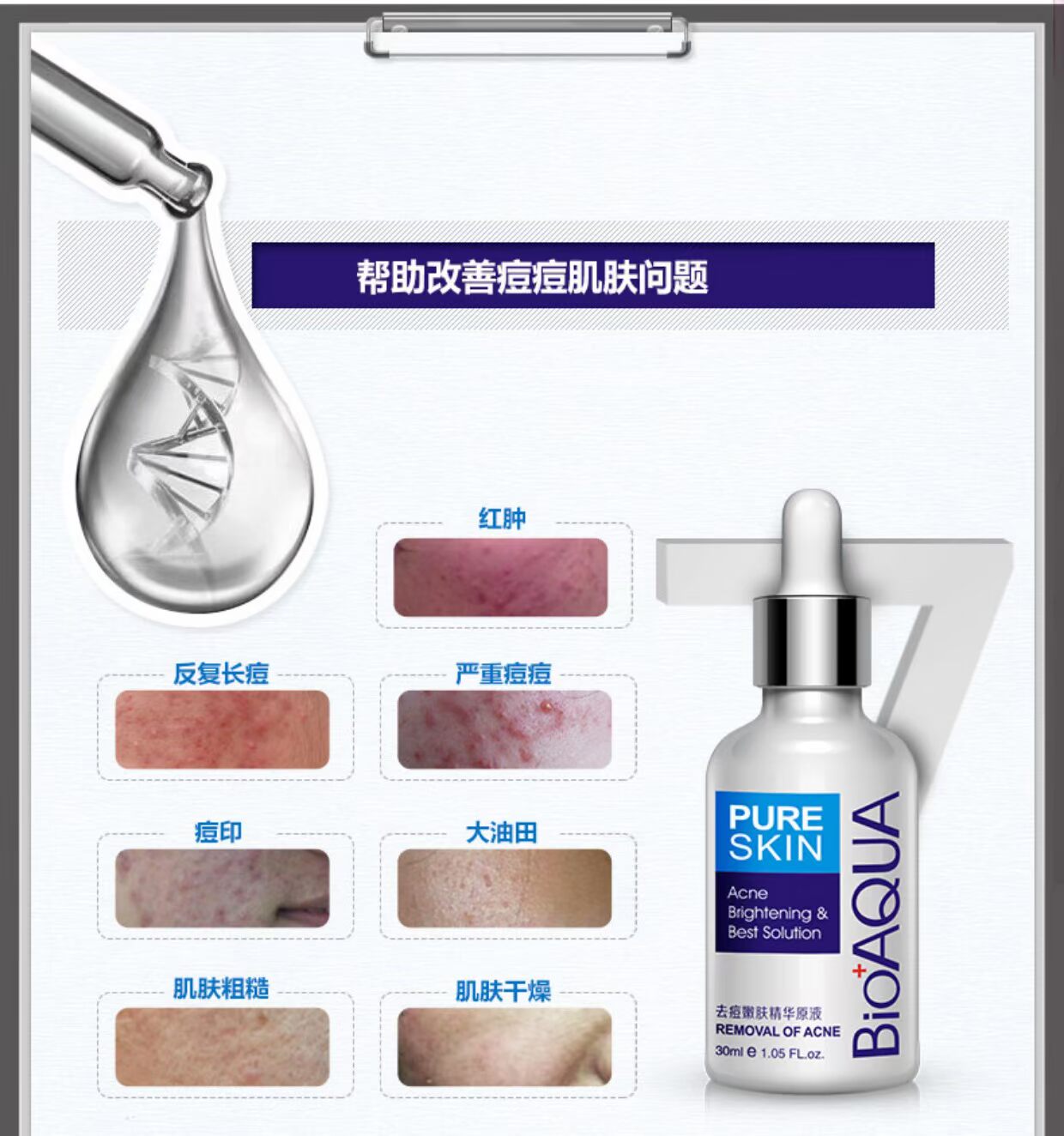 Tinh chất trị mụn Boquanya tinh dầu dưỡng ẩm kiểm soát nam giới và phụ nữ chăm sóc da mặt tinh chất sản phẩm chăm sóc da sum 37 vàng