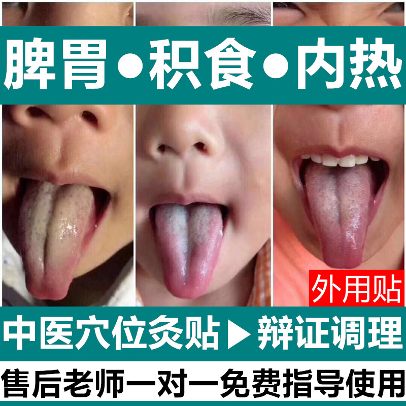Children Children Baby food patch Internal heat conditioning map Tongue Baby anorexia Bad breath spleen and stomach digestion patch Navel