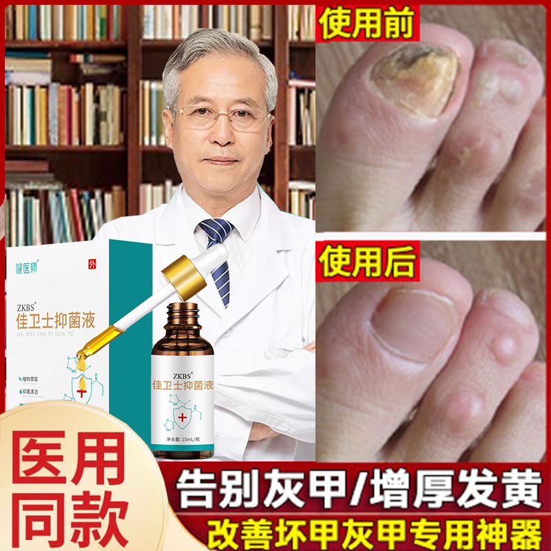 Thickened and Yellowed Toenails, Conceal Blemishes, Make Nails Thicker and Harder, Nail Nutrition Oil, Growth Liquid, Nail Care Oil, Nail Repair Liquid