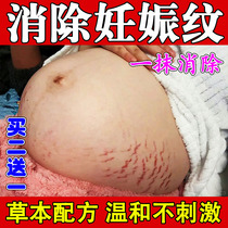 Stretch Marks Elimination Stretch Marks Removal Belly Firming Postpartum Elimination Thigh Obesity Marks Growth Marks Prevention and Firming