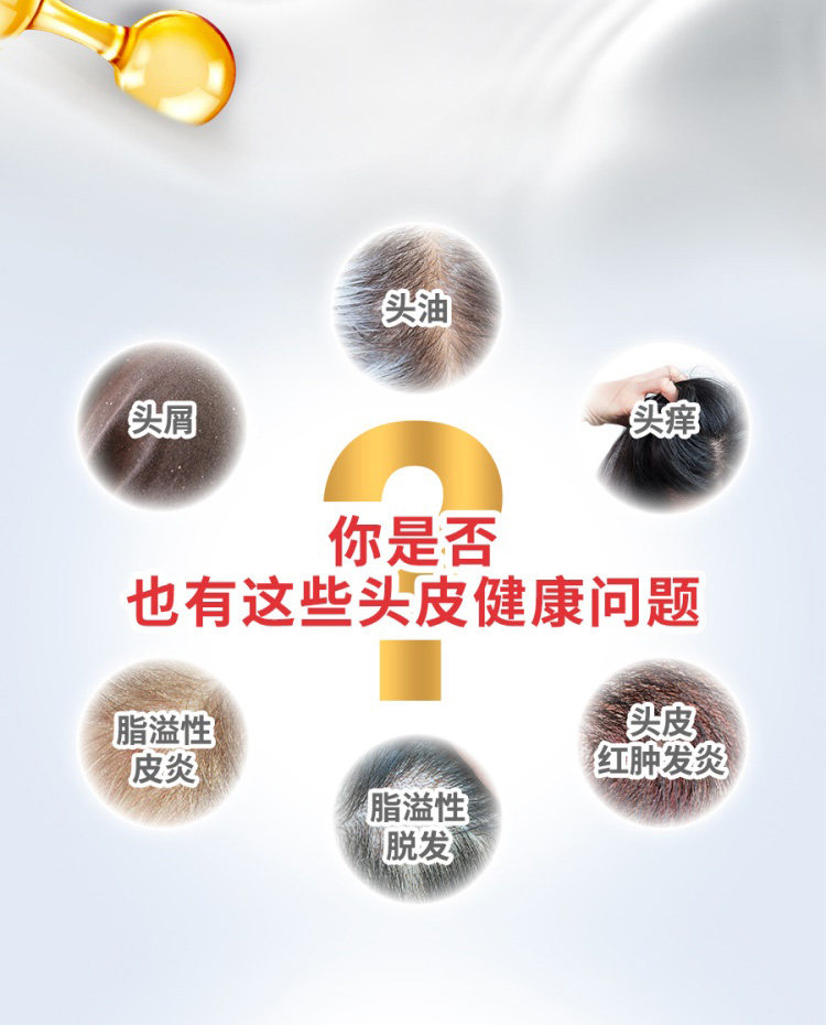 康王 酮康唑洗剂 50ml 聚划算天猫优惠券折后￥20包邮（￥35-15）