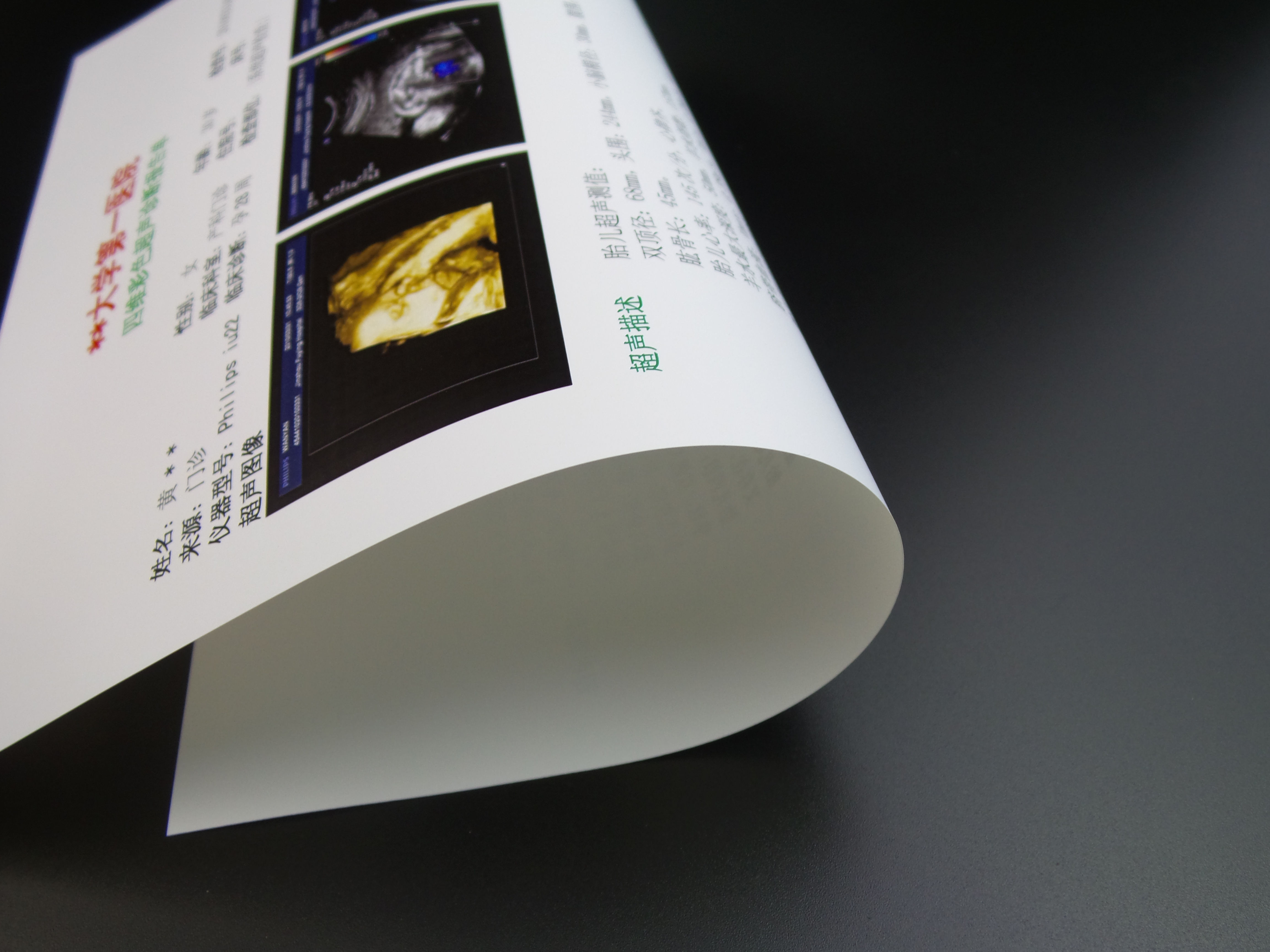 New medical film porcelain white high-gloss color Doppler ultrasound gastrointestinal endoscopy PET film inkjet color printing