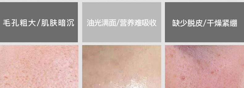 Gel tẩy tế bào chết cho nam Dead Skin Cleansing Facial Face Scrub Lotion Whitening Facial Cleanser Set tẩy da chết dành cho da dầu mụn