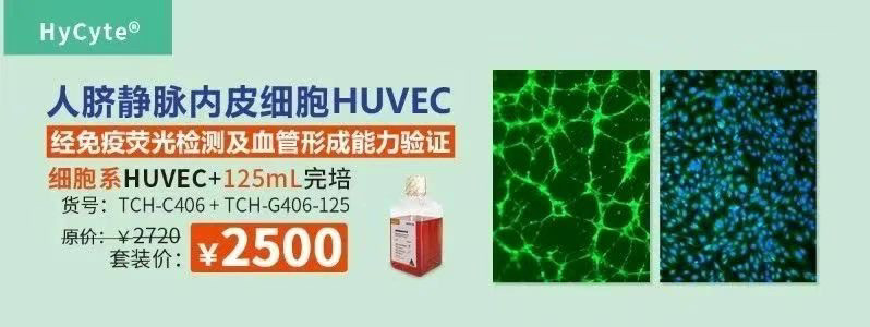 人脐静脉内皮细胞系(HUVEC细胞系)加完全培养基500m?l，TCH-C406