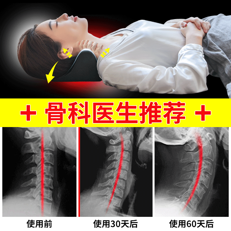頸椎枕頭反弓牽引矯正器勁椎病人富貴包專用理療修復糾正硬護頸枕 頸椎枕頭反弓牽引矯正器勁椎病人富貴包專用理療修復糾正硬護頸枕