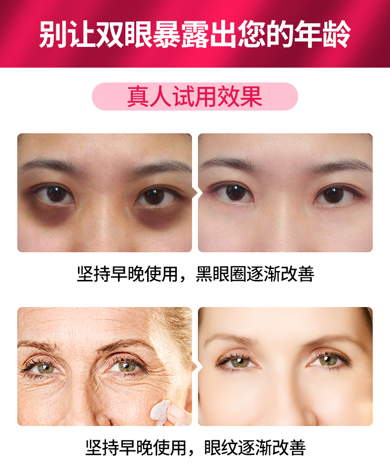 Mờ đỏ nhân sâm ốc peptide kem mắt để pha loãng quầng thâm mắt túi nếp nhăn làm săn chắc chống nhăn dưỡng ẩm chăm sóc mắt kem mắt nào tốt