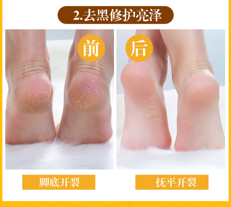 Sáo tình yêu mật ong chân sáp đến chết da già mềm mại trắng chân chân tẩy tế bào chết chân chăm sóc chân kem trị nứt gót