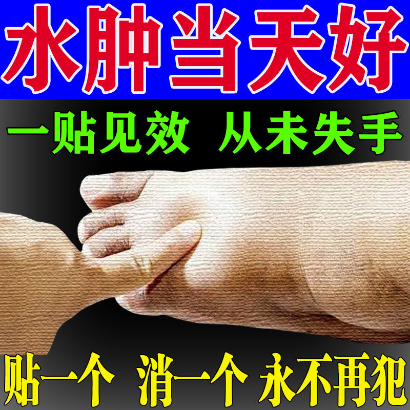 Deedema foot swollen edema deedema foot non-Japanese pastiedema stickup calf to lower limb edema face