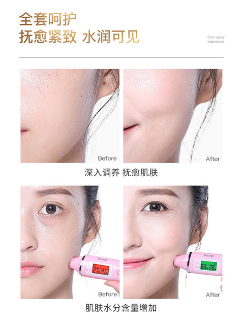 Bei Lingmei Golden Lady Cream Luxurious Nine-Piece Set Hydrating Moisturizing Water Cream Essence Skin Care Set Genuine Full Set