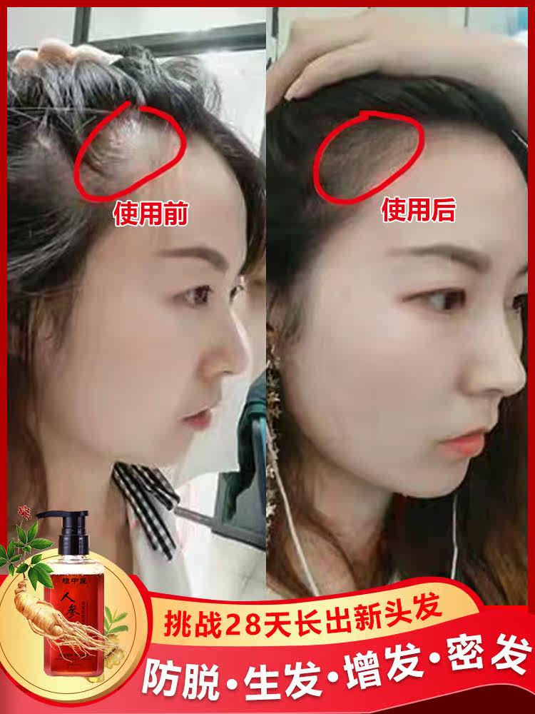 Ginseng essence shampoo anti-hair loss, anti-dandruff, anti-itching, no silicone oil, oil control, long-lasting fragrance, improve unisex