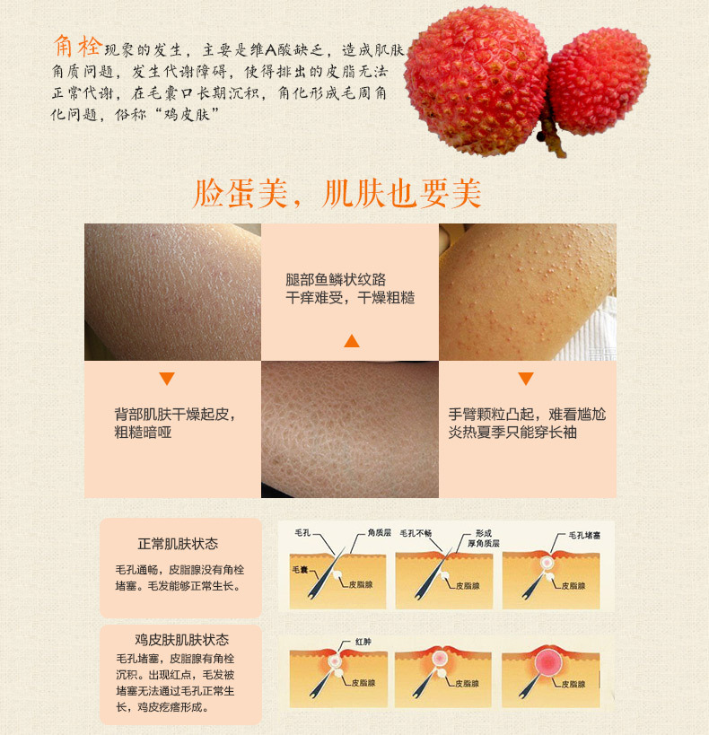 Yanxi sữa tắm da gà sớm da ngỗng chính hãng foll nang lông sừng rắn da chăm sóc cơ thể sữa sữa tắm em bé