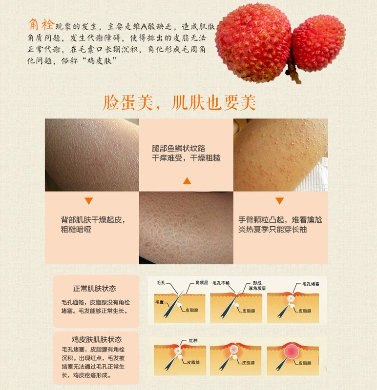 Yanxi sữa tắm da gà sớm da ngỗng chính hãng foll nang lông sừng rắn da chăm sóc cơ thể sữa
