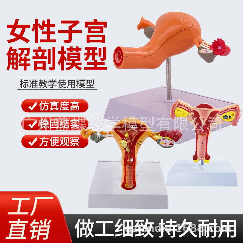 Medical Female Uterus Model, Ovary Reproductive Structure Anatomy Model, Gynecology and Obstetrics Ovary Uterus Model Medical Female Uterus Model, Ovary Reproductive Structure Anatomy Model, Gynecology and Obstetrics Ovary Uterus Model