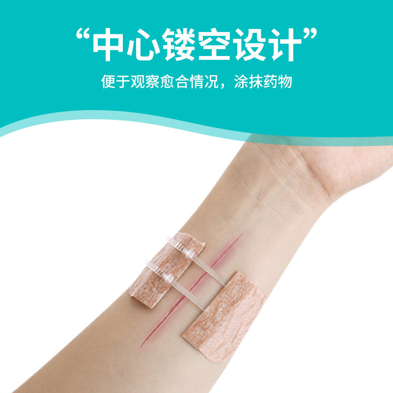 Jela Medical Skin Tension Reducer Suture Device Wound Reduction Patch Caesarean Section Scar Wound Tape No-Stitch Adhesive Tape Fn