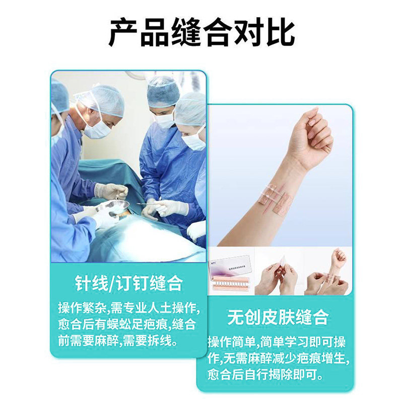 Jela Medical Skin Tension Reducer Suture Device Wound Reduction Patch Caesarean Section Scar Wound Tape No-Stitch Adhesive Tape Fn