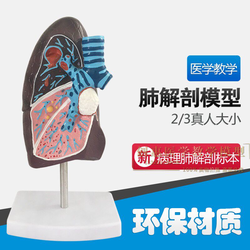 人体肺模型 病理肺解剖模型 呼吸系统 人体脏器模型 病变肺模型