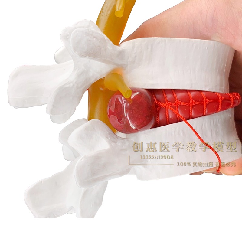 腰椎间盘tu出演示模型 脊柱模型医用 按摩推拿 腰椎模型 包邮