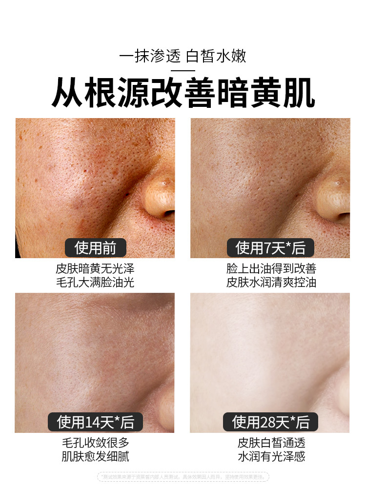 2 Bottles | Niacinamide Toner Genuine Product Hydrating Moisturizing Brightening Skin Tone Shrinking Pores Skin Care Lotion for Men and Women