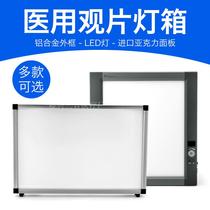  Luxury X-ray film viewing light Film viewing light led dental film viewing light box Film viewing light Triple film viewing light Double orthopedic