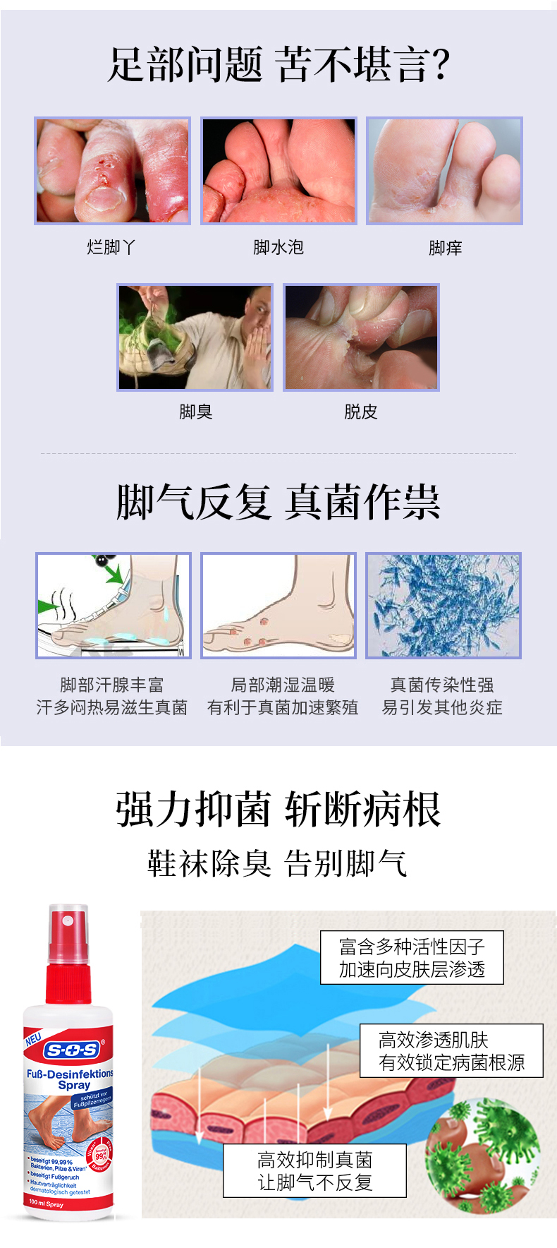 德国进口 SOS 去脚汗抑菌消毒除臭喷雾 100ml 图2