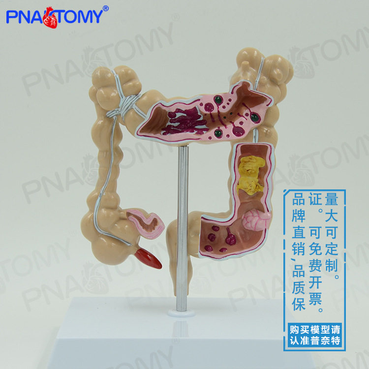 人体结肠大肠解剖模型肛肠科肠道肠胃消化系统教学