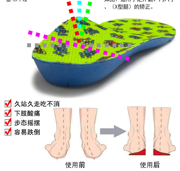 兒童扁平足腳足外翻矯正鞋墊矯正鞋X腿矯正寶寶內八字矯正器足弓