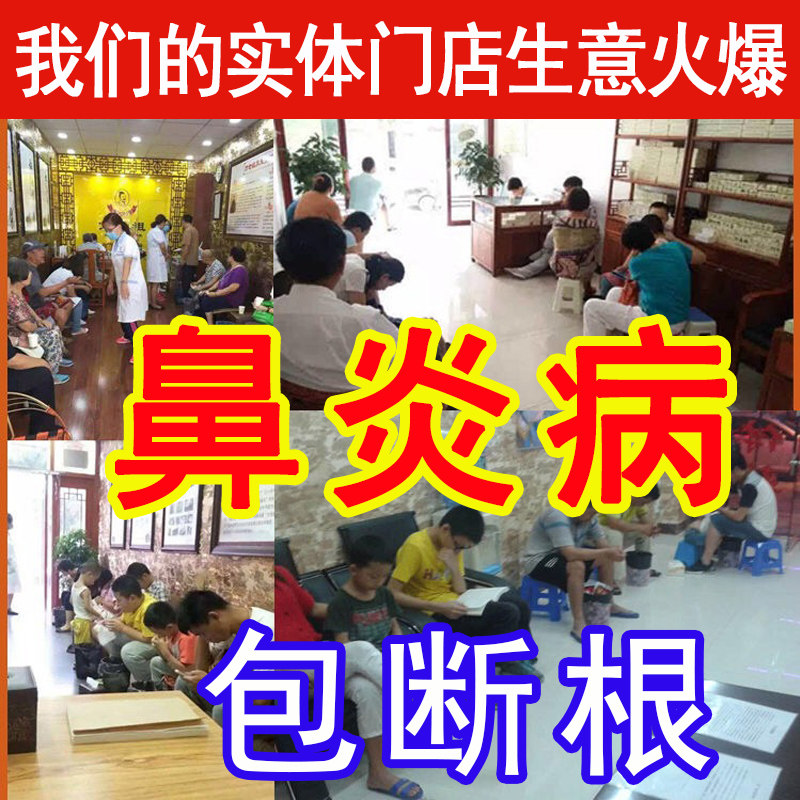 Miaojia rhinitis cream cure sinusitis Earthwork detoxification repair antibacterial root breaking Four seasons special effects Allergic effect