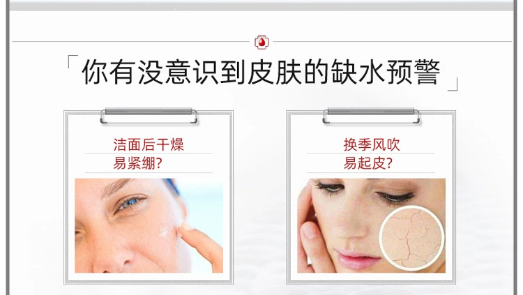 Trang web chính thức của Winona Mặt nạ dưỡng ẩm Winona Extreme 6 miếng dán giữ ẩm làm se khít lỗ chân lông nữ - Mặt nạ mặt nạ giấy innisfree