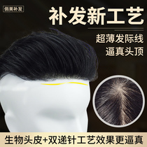 Mens wig Head hair replacement Male short delivery needle Real hair replacement block Forehead hairline Invisible incognito biological scalp