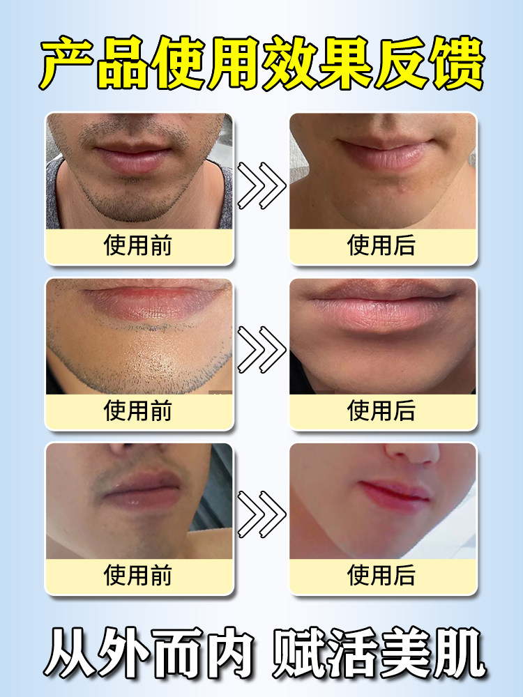 胡青去除男士淡化胡子黑印胡茬络腮胡唇毛胡根刮完护理遮瑕膏脸女,真的有效吗?_脱毛膏_淘宝美妆网